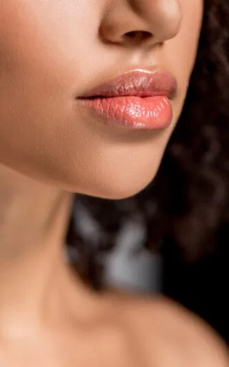 ladies face showing her lips after lip filler treatment